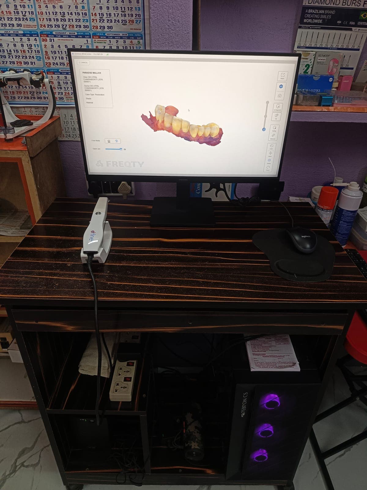 Digital Teeth Scanner